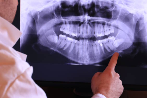 Best Dentist for Severe Toothache  in Lakewood Park, FL